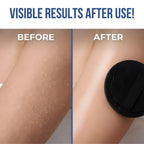 SoftScrub™ Exfoliating Pads