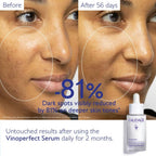 Before and after comparison of skin using Caudalie Vinoperfect Brightening Dark Spot Serum